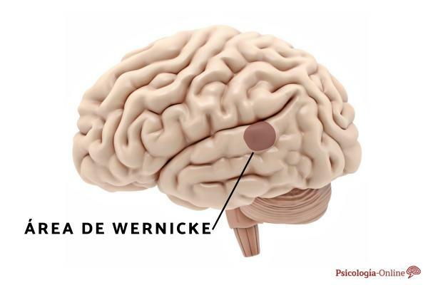 ความพิการทางสมองของ Wernicke: มันคืออะไร, อาการ, สาเหตุและการรักษา - ความพิการทางสมองของ Wernicke คืออะไร