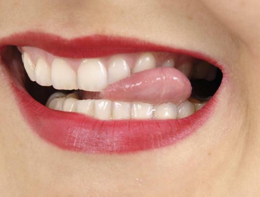 What does it mean to dream that your teeth fall out?