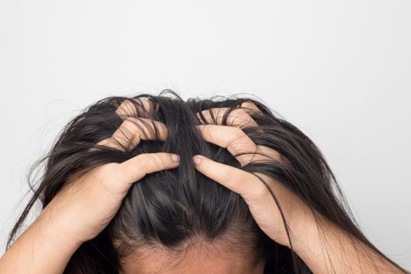 What is Trichotillomania: Causes and Treatment