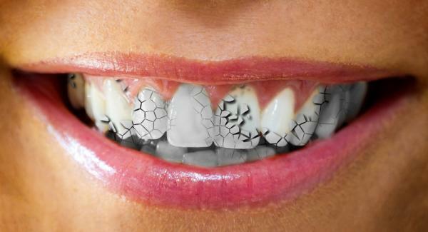 Význam snění o tom, že vám vypadne zub - Co to znamená snít o tom, že se vaše zuby pohybují 