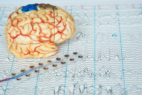 What is electroshock therapy and how does it work