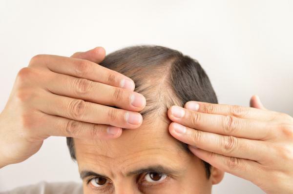 Alopecia nervosa: co to je, příznaky a léčba