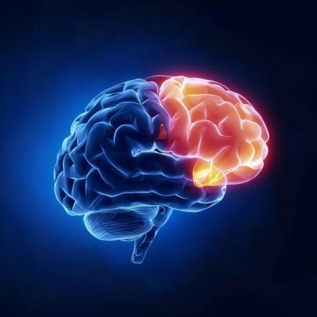 ภาวะสมองเสื่อม: มันคืออะไร ชนิด อาการ และสาเหตุ - ภาวะสมองเสื่อมส่วนหน้า